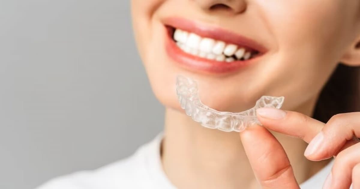 Reasons to Choose Invisalign